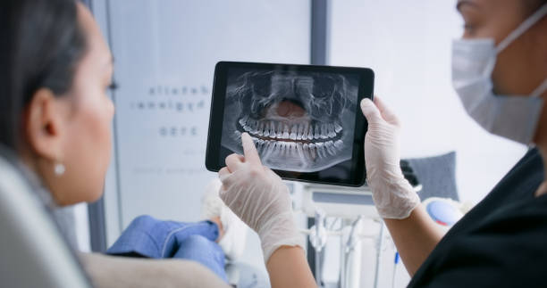 Licensed Tooth Extraction service in Port Washington, NY - Smile Center Dentistry